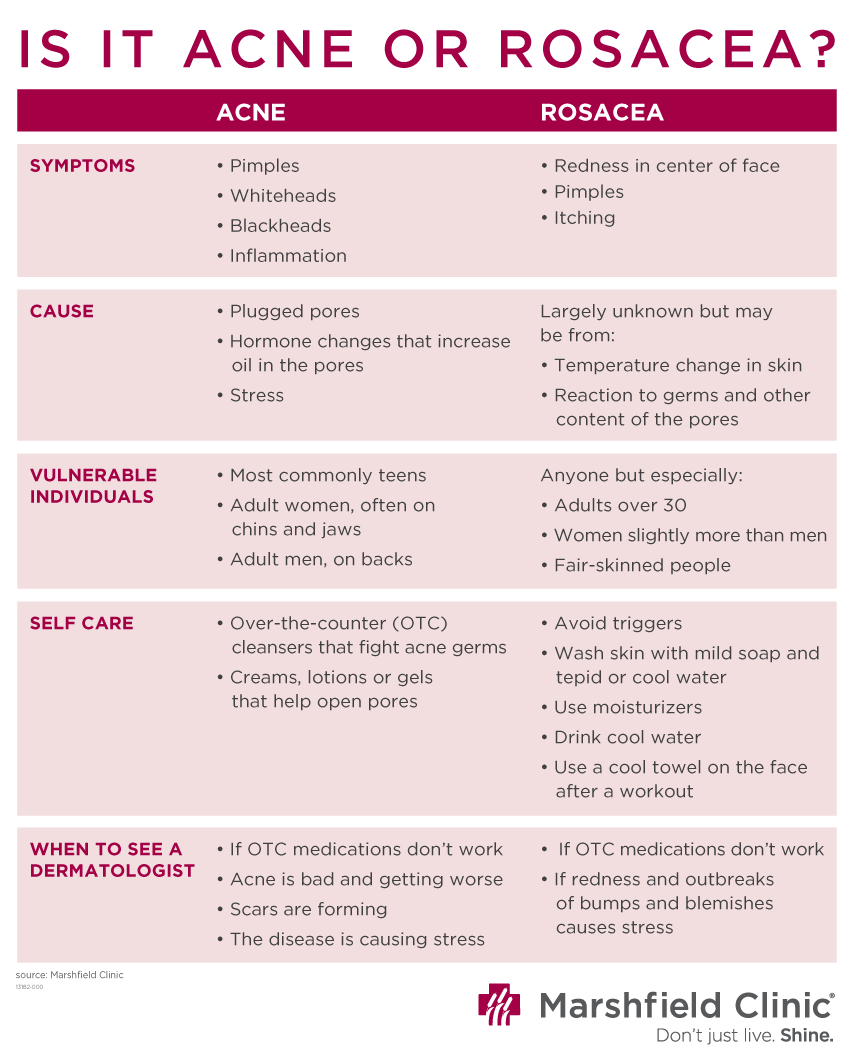 Acne vs rosacea chart