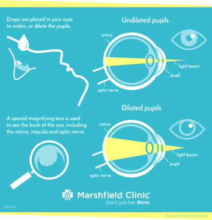 Chart showing differences in non-dilated vs dilated eyes during a dilated eye exam