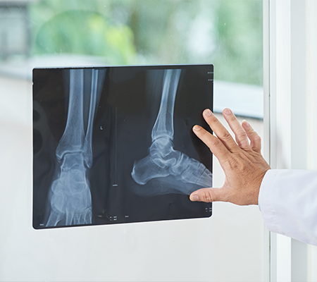 x-ray of ankle injury