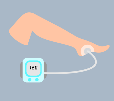 illustration of leg with a wound vac, vacuum assisted closure, negative pressure therapy
